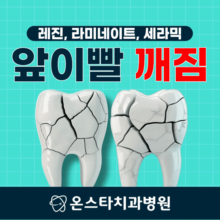  앞이빨 깨짐 받아야 할 치료는?