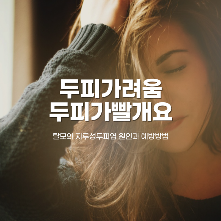  두피가빨개요 두피가려움 탈모 지루성두피염 원인과 예방