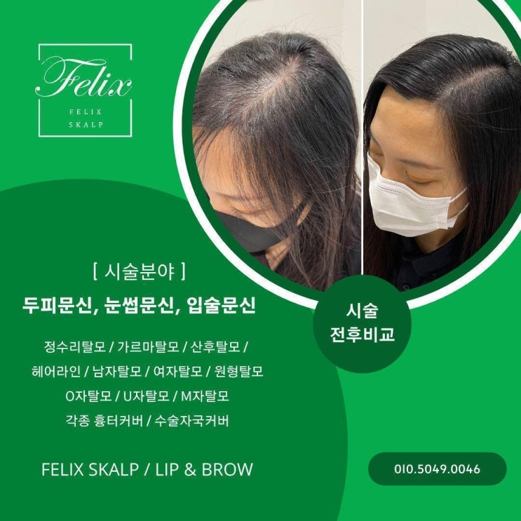  구래동두피문신 잘하는곳_ 필릭스스칼프