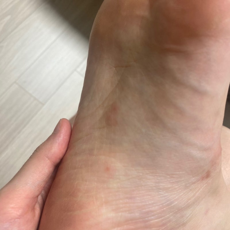 새집 먼지 다듬이 퇴치 준비 + 세스코 상담 후기
