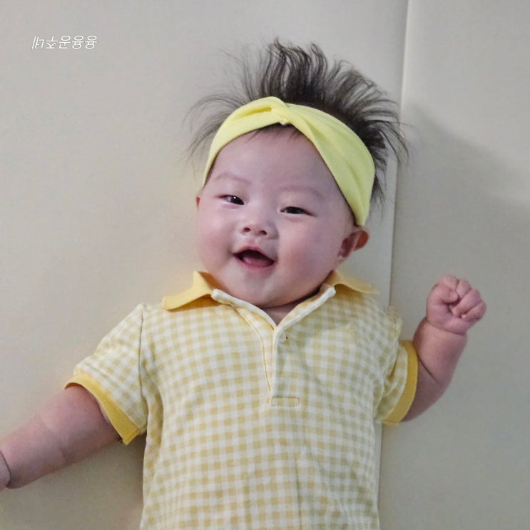  146일 - 152일 4개월 접종열 단두증 이노야드 두상교정센터