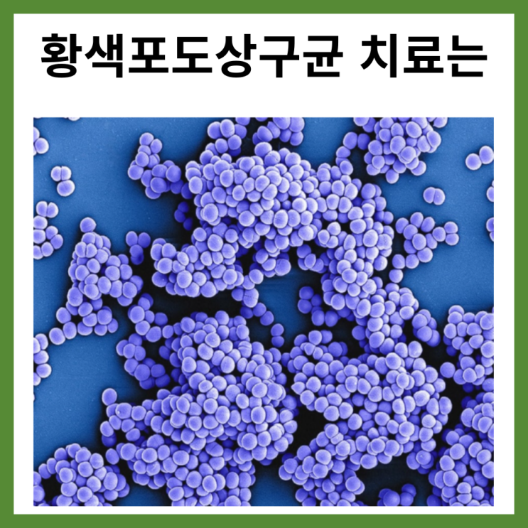  황색포도상구균 치료는