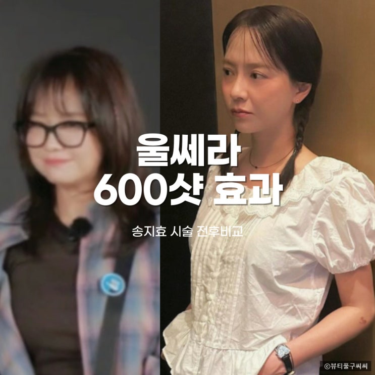  울쎄라 송지효 600샷 효과 특징 주의사항
