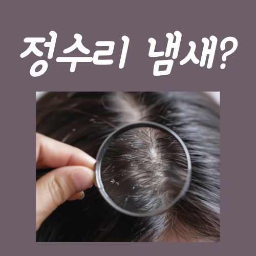  정수리냄새 없애는법? 딱 3가지만 그대로 따라하세요