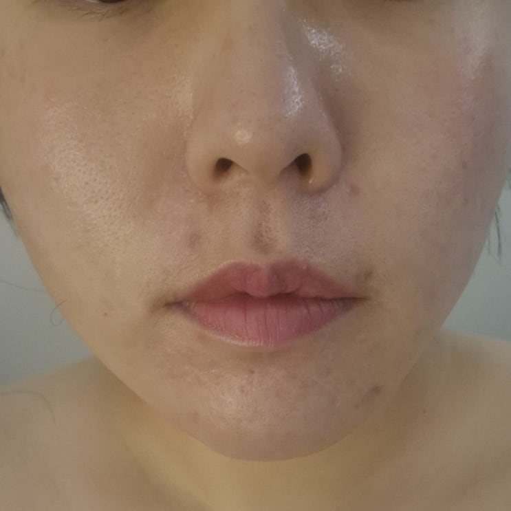  일직동 피부관리 잘하는 에스테틱타임 물방울리프팅