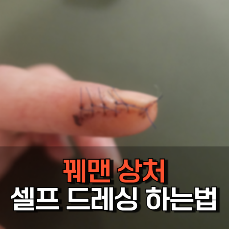 손가락 꿰맨 상처 셀프 드레싱 하는법 손가락 꿰맨 상처 셀프 드레싱 하는법