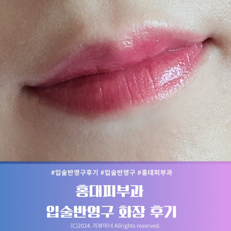  홍대피부과 입술반영구 화장 찐후기_통증, 탈각, 부작용, 유지기간