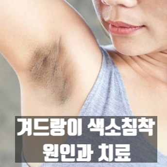  겨드랑이 색소침착의 원인과 치료 (겨드랑이 착색)