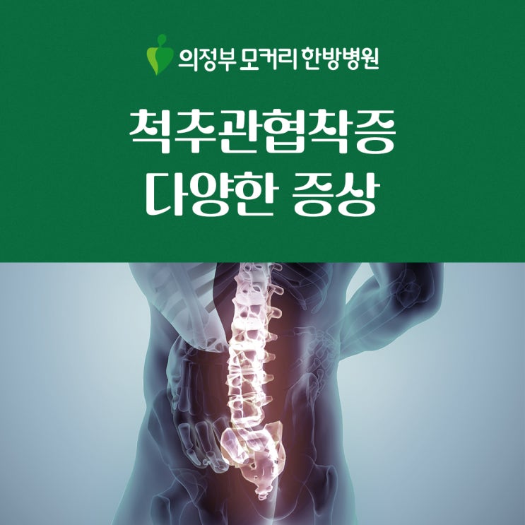  척추협착증의 다양한 증상과 진단 | 의정부 모커리한방병원