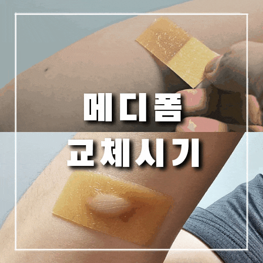  화상 입었을 때 메디폼, 듀오덤 진물 교체시기와 사용법은?