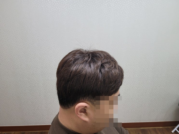  대구가발추천 권유드리고 싶은 이유