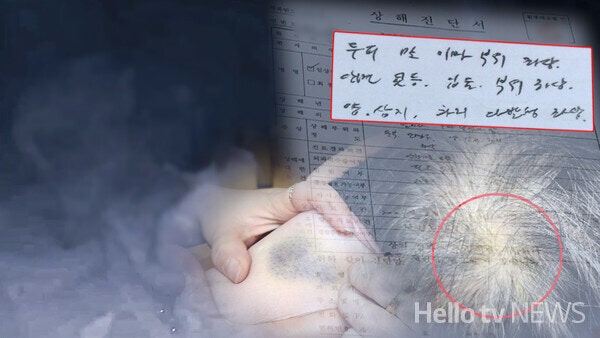'노인 학대 혐의' 송치…행정처분은 고작 '개선 명령' '노인 학대 혐의' 송치…행정처분은 고작 '개선 명령'