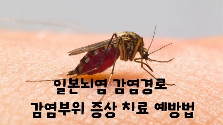  일본뇌염 전파경로 뇌감염 증상 예방법 백신접종