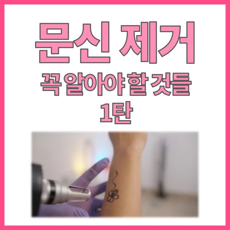  문신제거를 원하신다면 꼭 아셔야 할 것들 - (1/2)