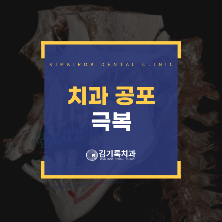 매탄동 추천 치과 공포증 환자의 전악 임플란트 성공 사례