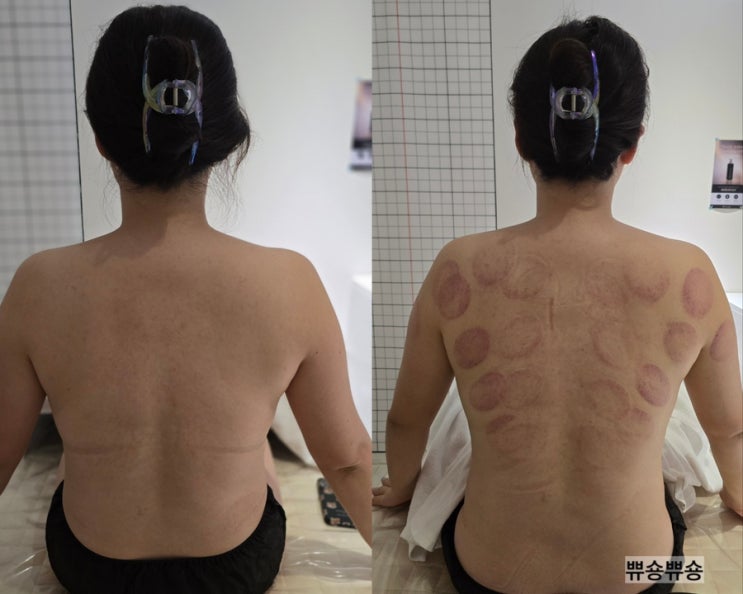  잠실다이어트 숨은 라인을 찾아주는 방이동바디관리 유오브미바디