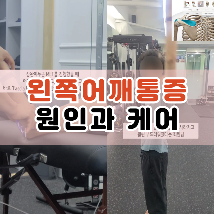  동래PT 온천장재활피티 왼쪽어깨통증원인 근신경계와 근막컨디셔닝테크닉으로 케어해요.