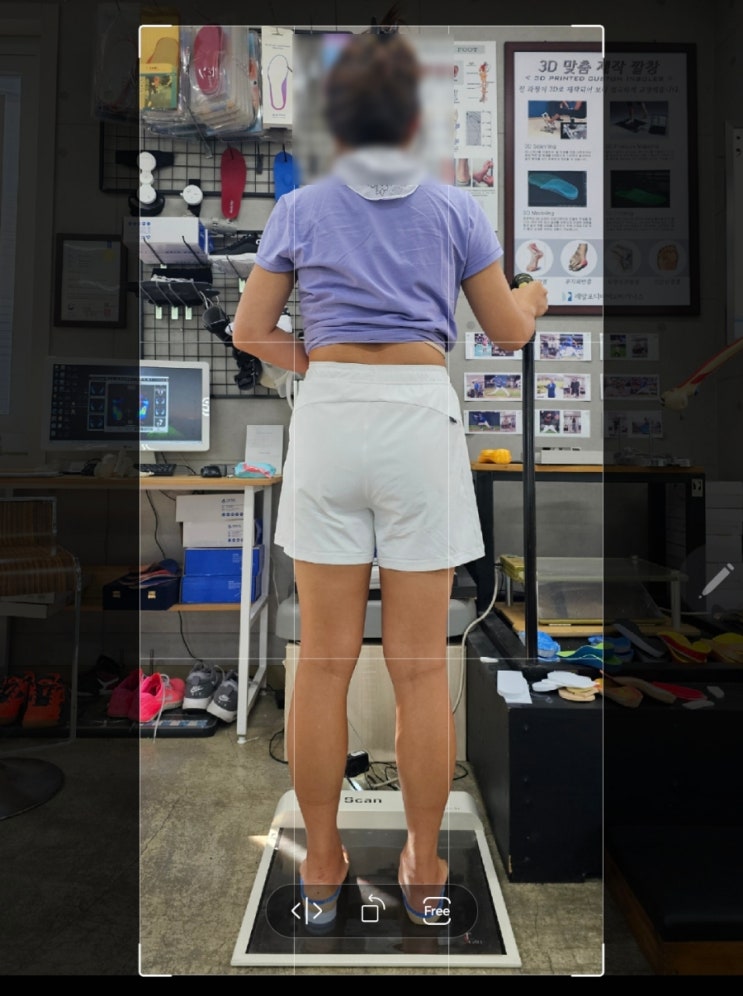  안면(얼굴) 비대칭, 근본적인 원인은?