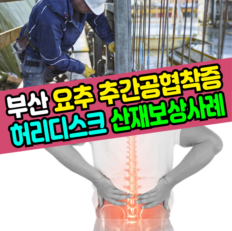  [부산 노무사] 요추 추간공협착증 허리디스크 산재 보상사례