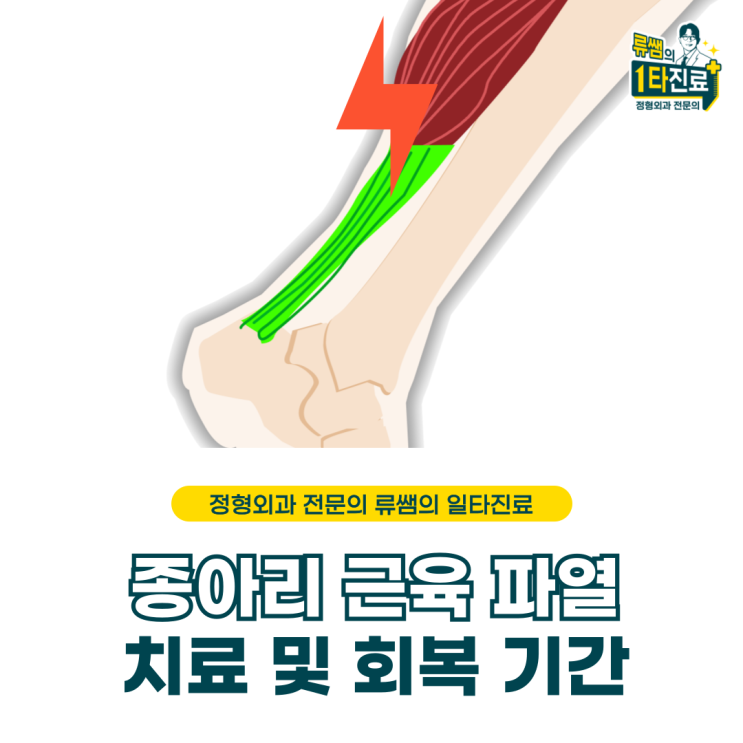  종아리 근육 부분 파열, 치료 방법 및 회복 기간 (의사 작성)