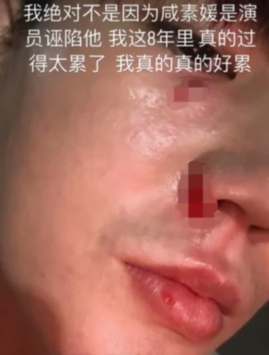 <b>진화</b> 피흘리는 얼굴로 <b>함소원</b> 폭행 불화 폭로(ft. 나이차이)