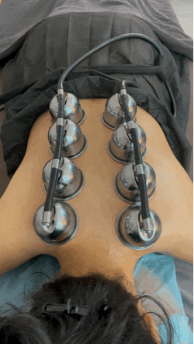  부산 서면에스테틱 승모근관리 신부관리 전포 등관리 신부관리 : 셀스테틱 부산서면점