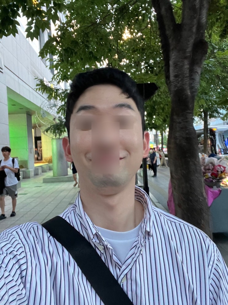  홍대슈링크 후기 | 남자 레이저리프팅효과 찐 후기