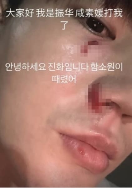 <b>진화</b> 아내 폭행 18살 연하 남편 <b>함소원</b> 이 때렸어. 폭로 부부... 