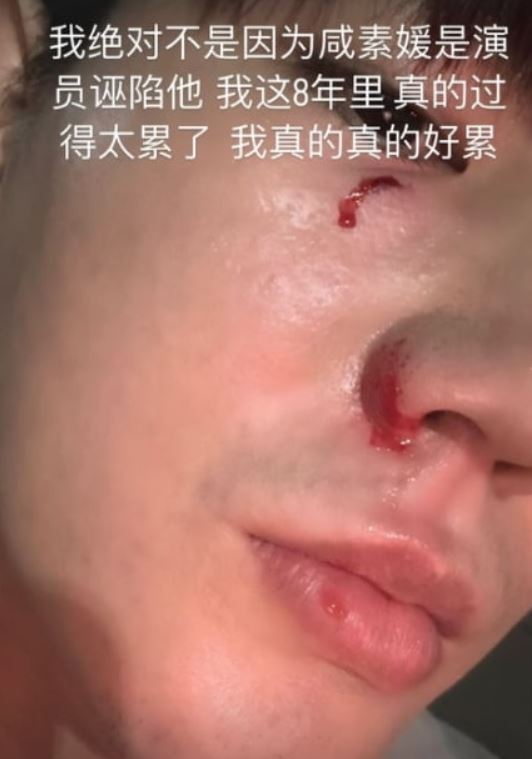 "8년 간 힘들었다" <b>함소원</b> 폭력 주장하며 남편진화가 올린사진... 