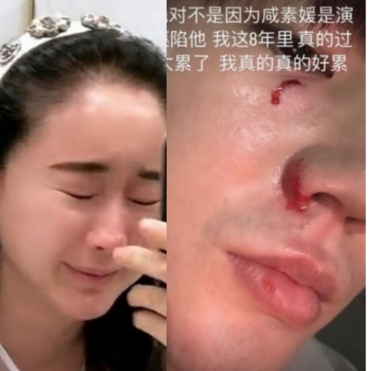 "<b>함소원</b>에게 맞았다" 18연하 중국인 남편 '<b>진화</b>' 폭로 '피 범벅... 