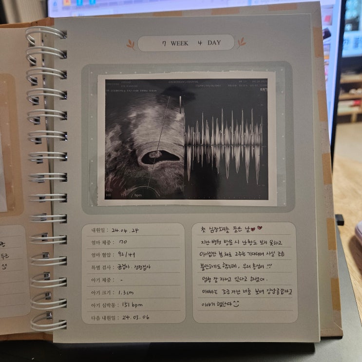  [임신준비/초음파앨범] 태아 초음파 사진앨범 추천/비추천