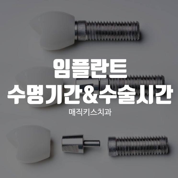  임플란트 수명 기간과 수술시간