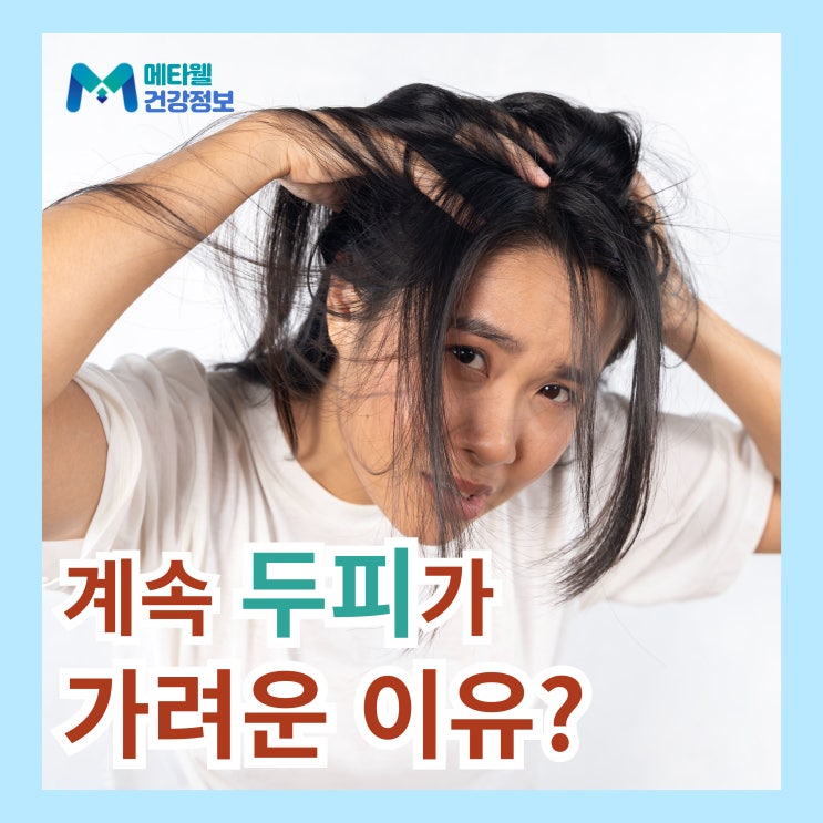  두피 가려움 원인 두피가 자꾸 가려운 이유 비듬 머리 간지러움