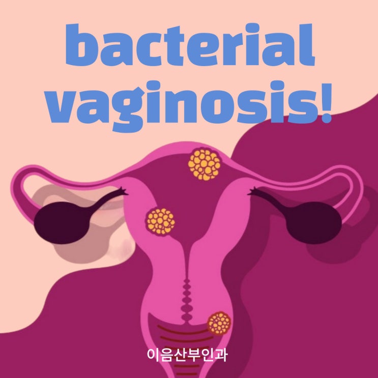 교대역 산부인과 세균성 질염 진단 및 치료