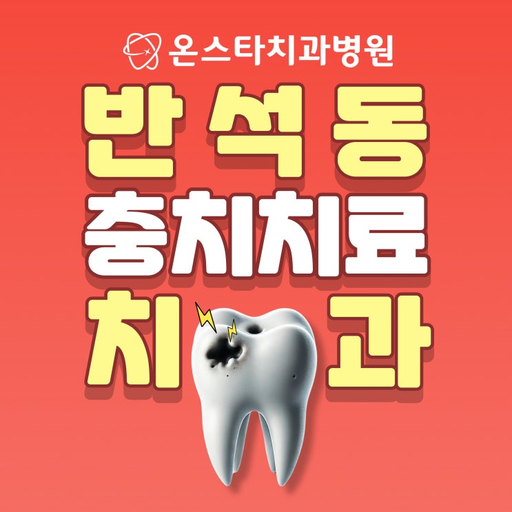  대전 반석동 치과 충치치료 과정과 예방
