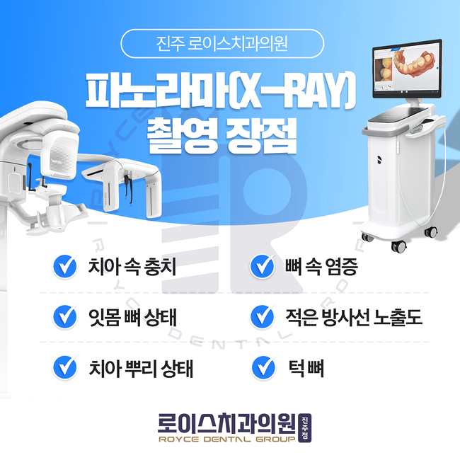  진주치과  "매복 사랑니 발치는 로이스치과에서!"