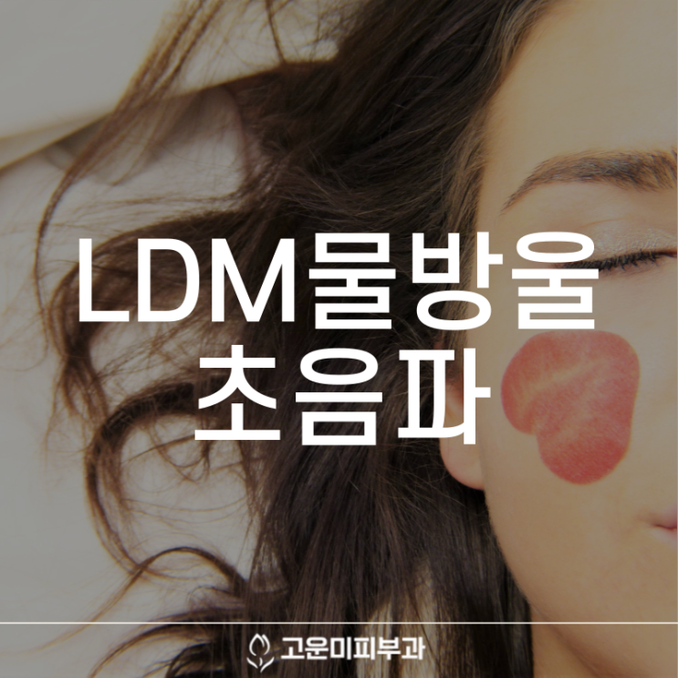  대구홍조치료 고밀도 초음파로 홍조와 아토피를 개선하고 피부 탄력 효과를 얻는 LDM 물방울 초음파