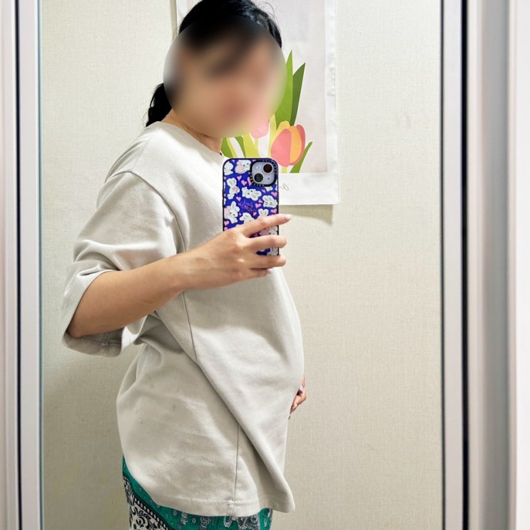  임신 20주 환도 선다 뜻 위치 증상 임산부 발바닥 통증
