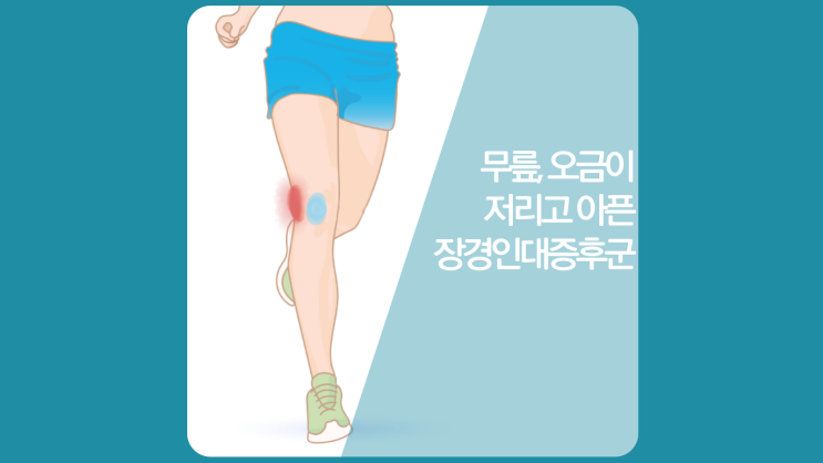  달리기·자전거 무릎·오금통증, 오금저림 (오금뜻, 위치) 장경인대증후군(러너스니)