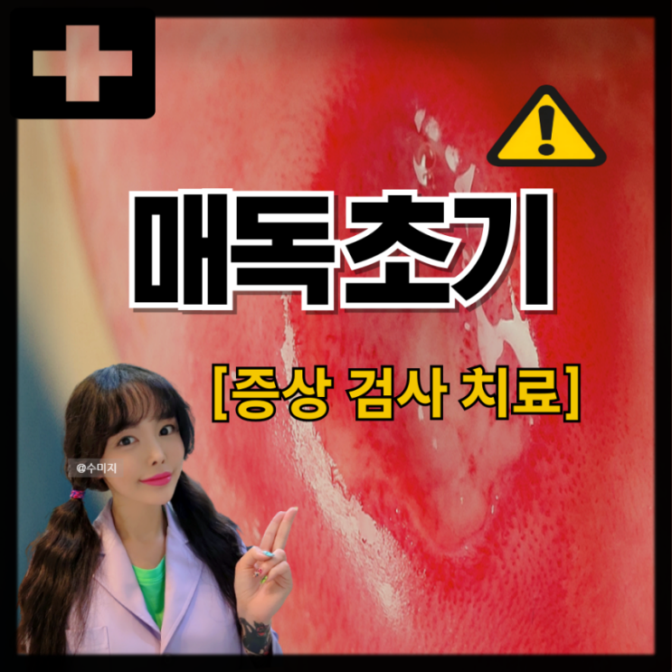  매독 잠복기 성병 여자 남자 매독 증상 피부발진 궤양 검사 매독 치료