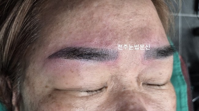  전주눈썹문신제거 후 재작업 완벽해!