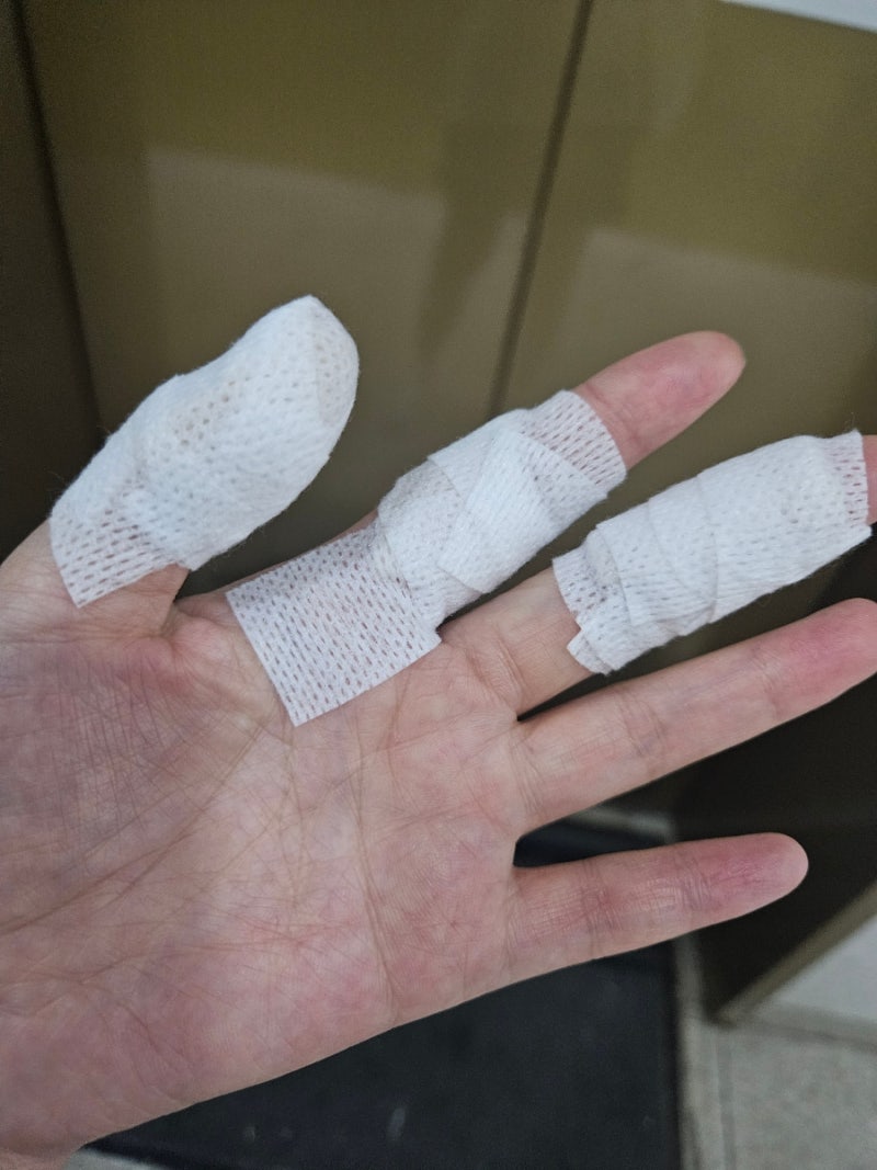 광주 화상병원 시원외과 2도화상치료 화상처치
