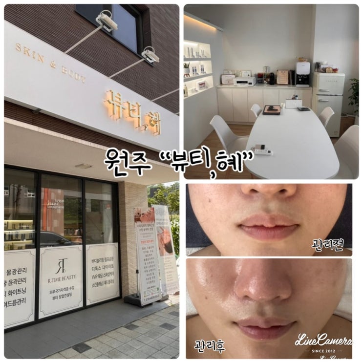  "뷰티,혜" 1:1맞춤관리로 원주피부관리 잘하는곳