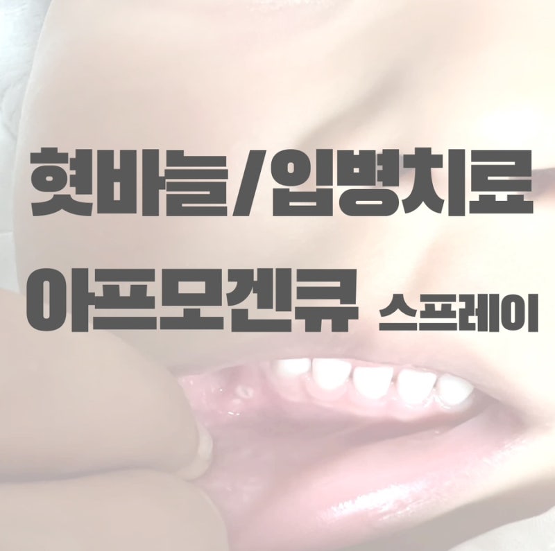 어린이 혓바늘 입병치료 구내염 통증 완화 아프모겐큐 뿌리는 스프레이