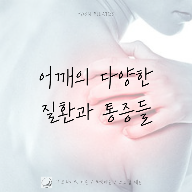  [춘천필라테스] 어깨통증의 다양한 원인들과 운동(어깨결림, 어깨염증, 어깨충돌증후군, 석회염, 오십견 등)
