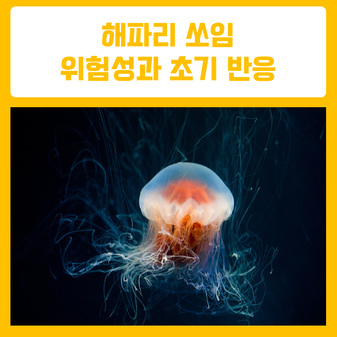  여름철 필수 상식 해파리 쏘였을 때 대처법 5가지