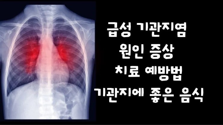  급성 기관지염 기침 가래 원인 증상 감염 치료 항생제 음식