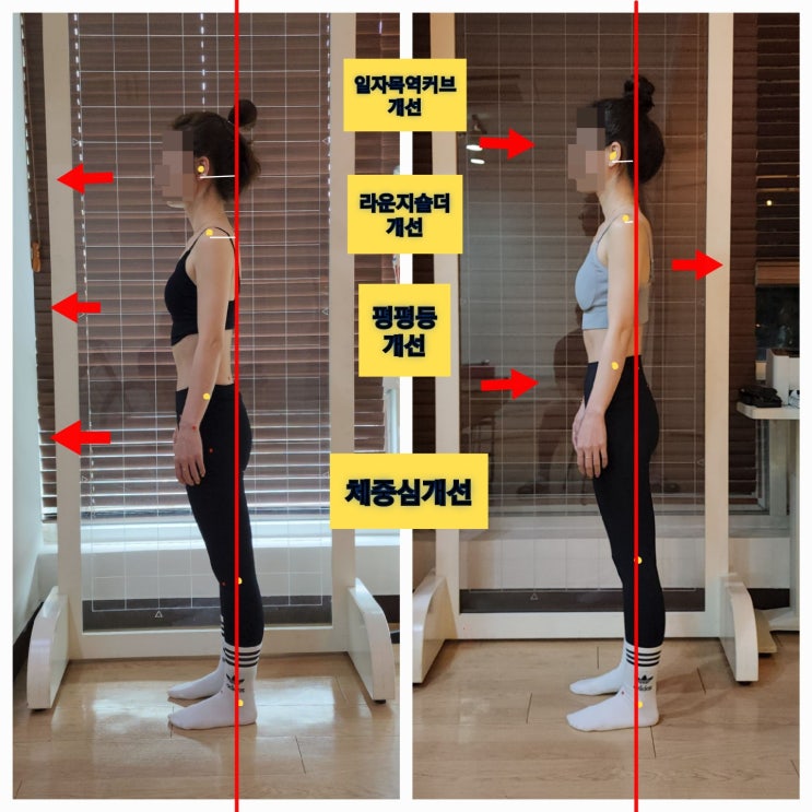  [동래 사직동 필라테스] 일자목두통과 목어깨 결림을 호소하신 회원님 개선후기
