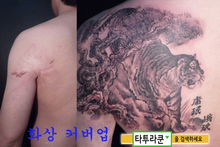  화상흉터 커버업-화상의 질감을 살려서 소나무로 덮었습니다./흉터커버업/흉터문신 [홍대 타투라쿤]-2013. 3. 19. 20:31