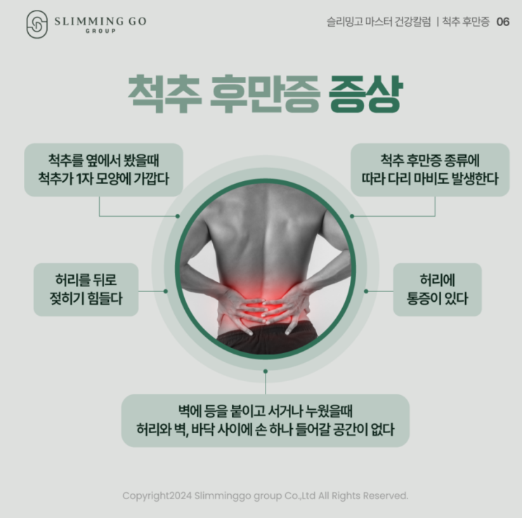  [슬리밍고 건강tip] 꼬부랑할머니병 척추후만증 증상 및 자가 진단표